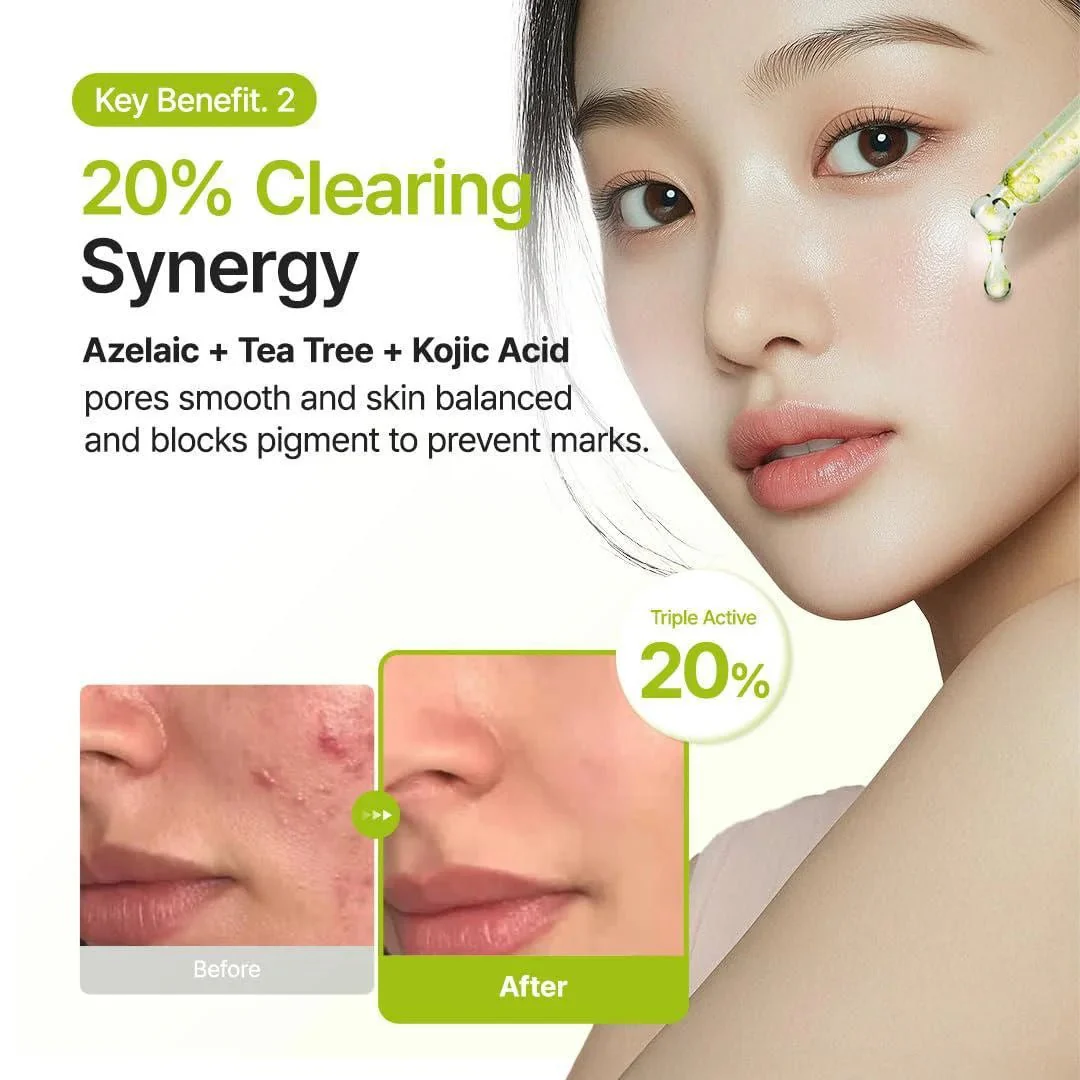 Purito Seoul Azelaic Acid 10 Kojic Tea Tree Serum – Pattanások Elleni Szérum 30ml - Image 4
